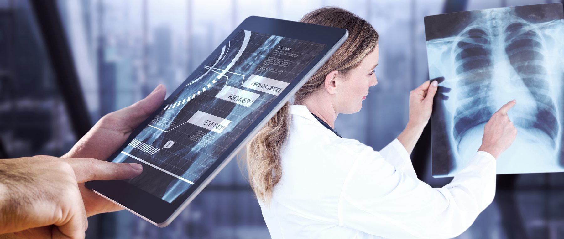 Physician reviewing a chest X-ray
