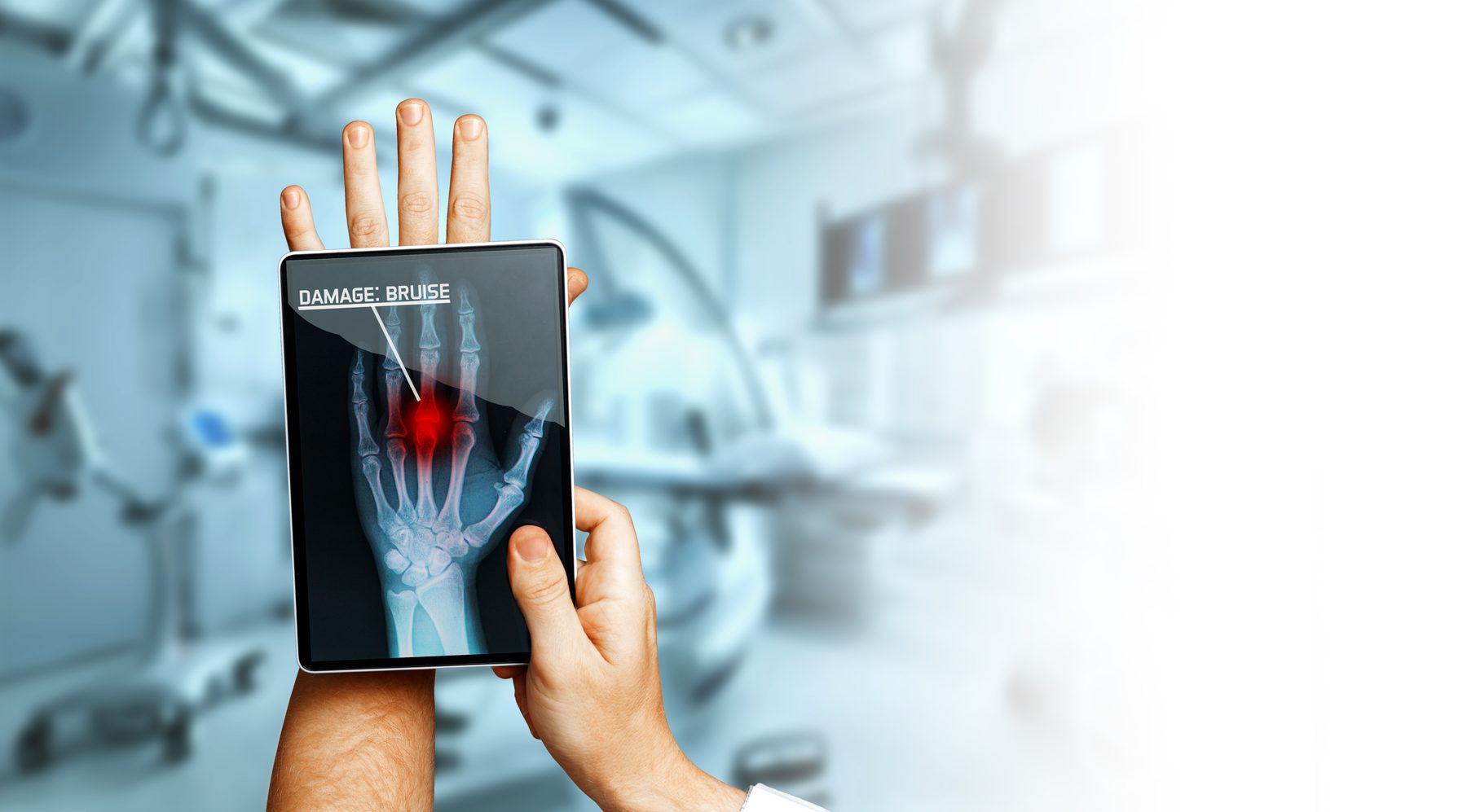 Digital X-ray shown on a tablet